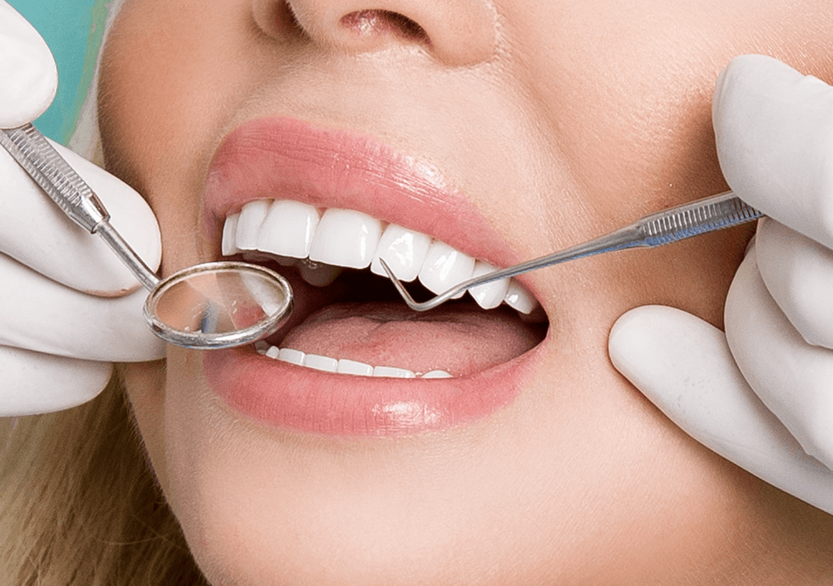 Tooth Whitening in Los Angeles, CA