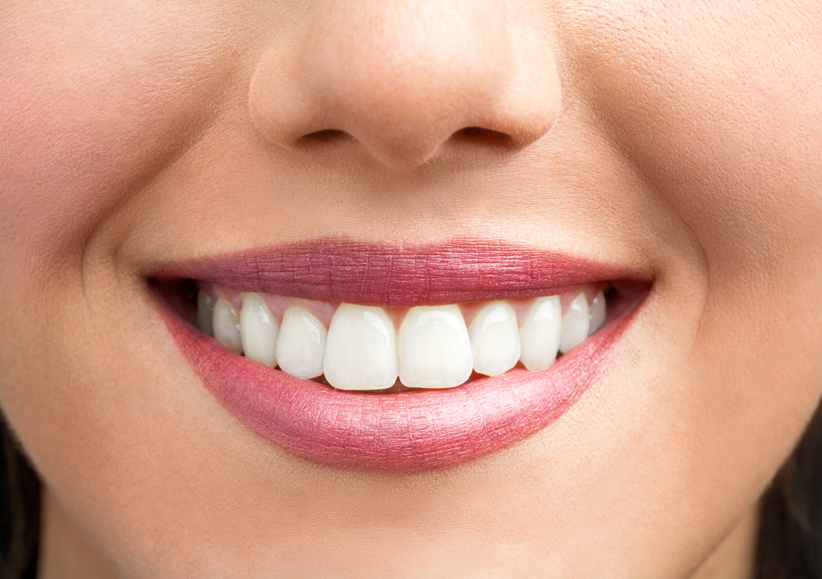 The best teeth whitening solutions in Los Angeles, CA
