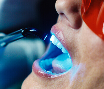 Enjoy Laser-assisted Dental Treatments in Los Angeles, CA Area