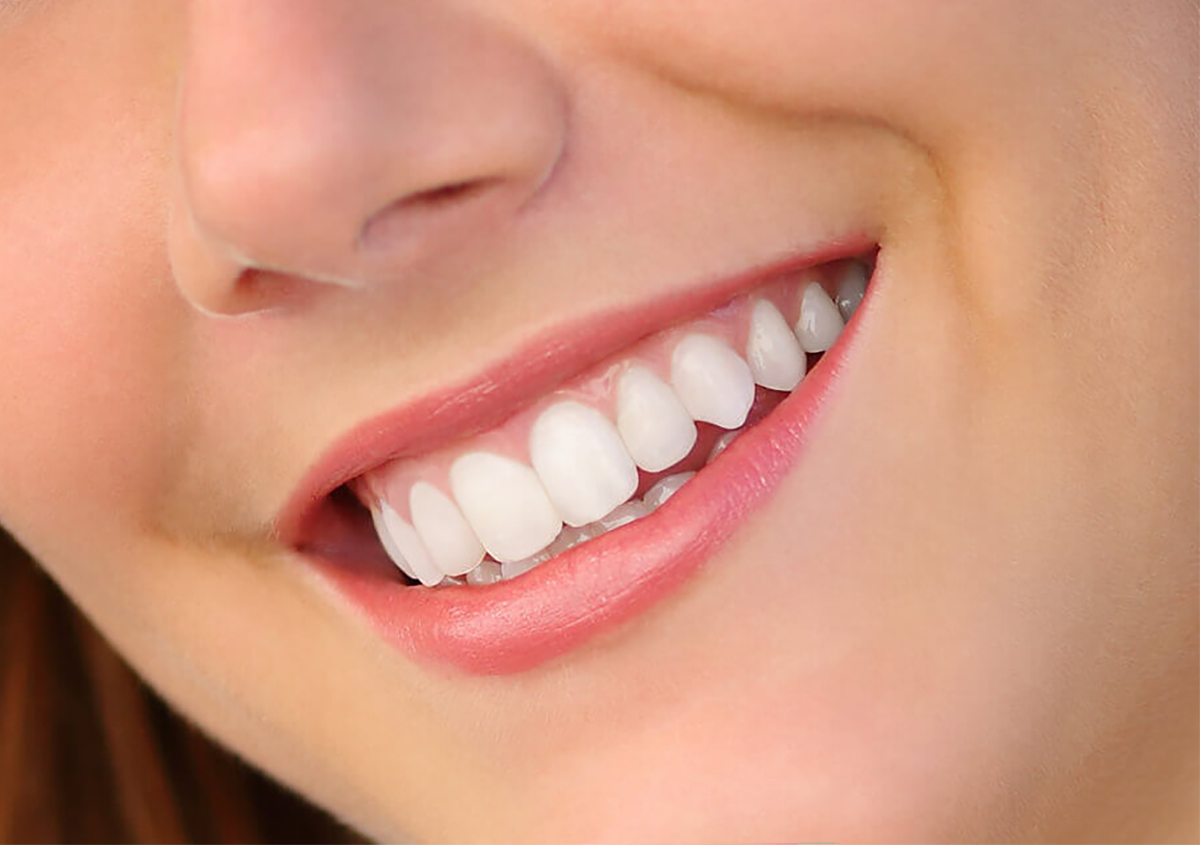 Cosmetic Dental Surgery in Los Angeles Area