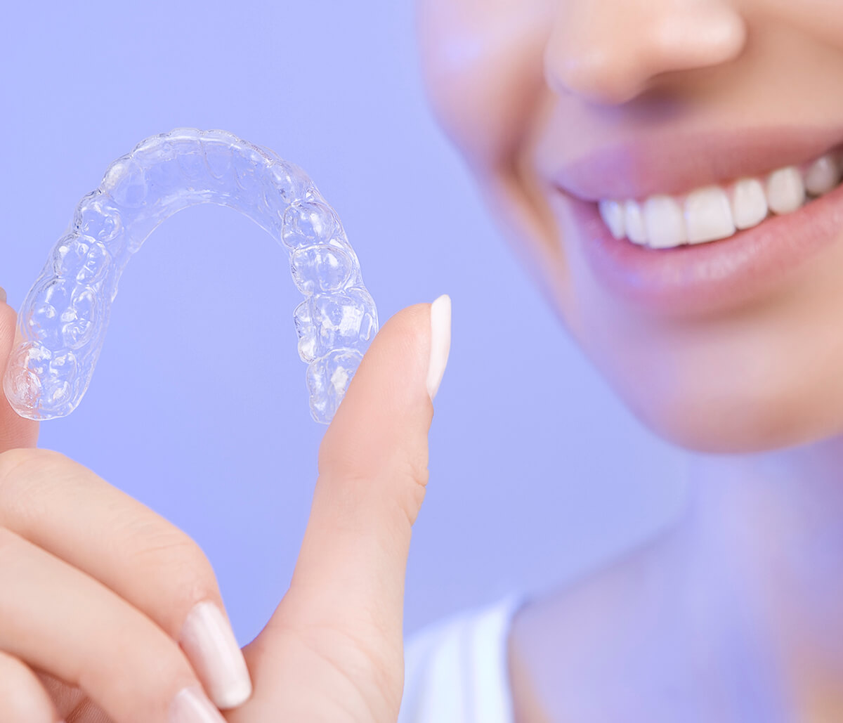 Invisalign Experience in Los Angeles Area