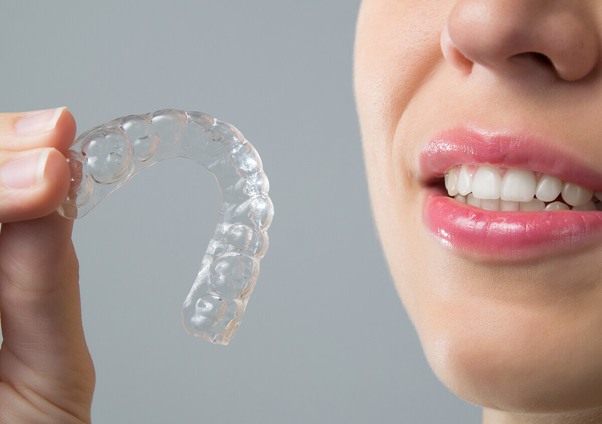 Invisalign Clear Braces in Los Angeles Area