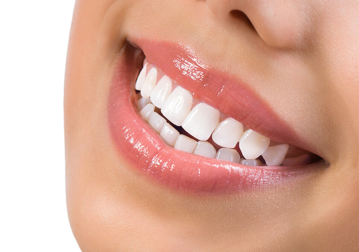 Teeth Cleaning Services in Los Angeles CA Area